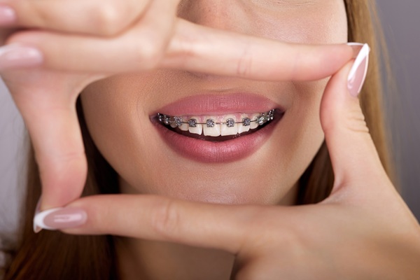 Finding The Right Teen Orthodontist For Your Child