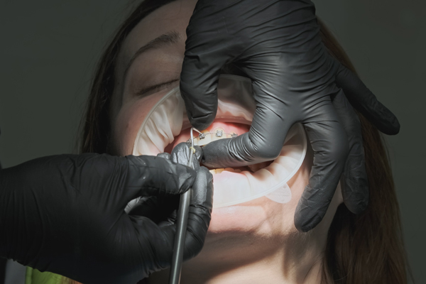 Get The Perfect Smile With A Personalized Smile Makeover Plan
